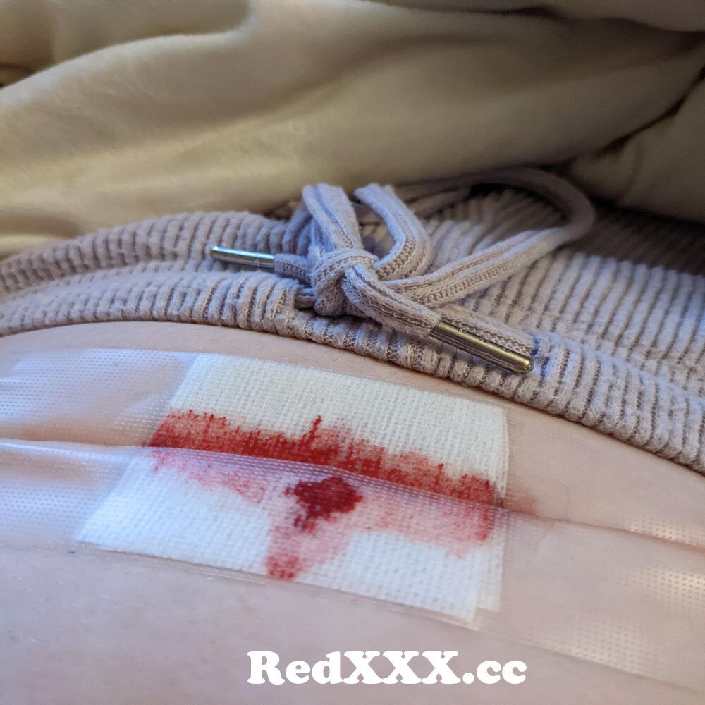 Bleeding pussy porn-xxx pics